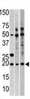 Ribosomal Protein L23a antibody, abx030993, Abbexa, Western Blot image 