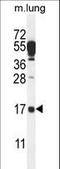 D-Aminoacyl-TRNA Deacylase 2 antibody, LS-C167911, Lifespan Biosciences, Western Blot image 