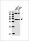 5-Phosphohydroxy-L-Lysine Phospho-Lyase antibody, orb1304, Biorbyt, Western Blot image 