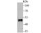 Forkhead box protein F2 antibody, NBP2-80417, Novus Biologicals, Immunohistochemistry paraffin image 