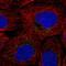 Proto-oncogene tyrosine-protein kinase ROS antibody, NBP2-56053, Novus Biologicals, Immunofluorescence image 