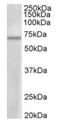 Protein Arginine Methyltransferase 3 antibody, orb12332, Biorbyt, Western Blot image 