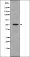 Fibroblast Growth Factor Receptor 2 antibody, orb335816, Biorbyt, Western Blot image 