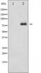 Forkhead Box O1 antibody, TA325477, Origene, Western Blot image 