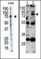 Matrix metalloproteinase-9 antibody, AP13187PU-N, Origene, Western Blot image 