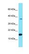 Family With Sequence Similarity 222 Member A antibody, orb326836, Biorbyt, Western Blot image 
