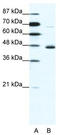 Neuronal Differentiation 1 antibody, TA329757, Origene, Western Blot image 