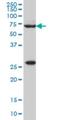 WASP Family Member 2 antibody, H00010163-M02, Novus Biologicals, Western Blot image 