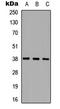 Cathepsin L antibody, LS-C354314, Lifespan Biosciences, Western Blot image 
