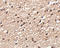 STE20/SPS1-related proline-alanine-rich protein kinase antibody, A02516, Boster Biological Technology, Immunohistochemistry paraffin image 