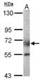 Polypeptide N-Acetylgalactosaminyltransferase 2 antibody, NBP1-32394, Novus Biologicals, Western Blot image 