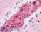 Mediator Complex Subunit 17 antibody, LS-B6197, Lifespan Biosciences, Immunohistochemistry paraffin image 