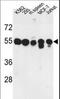 Protein phosphatase 1H antibody, LS-C162073, Lifespan Biosciences, Western Blot image 