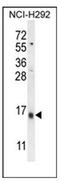 Lymphocyte Antigen 6 Family Member G6C antibody, AP52564PU-N, Origene, Western Blot image 