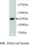 Tyrosine Kinase With Immunoglobulin Like And EGF Like Domains 1 antibody, MBS355080, MyBioSource, Western Blot image 