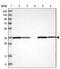 Zinc Finger And BTB Domain Containing 37 antibody, PA5-54799, Invitrogen Antibodies, Western Blot image 