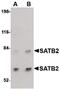 DNA-binding protein SATB2 antibody, PA5-20533, Invitrogen Antibodies, Western Blot image 