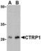 C1q And TNF Related 1 antibody, TA306230, Origene, Western Blot image 