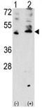 Vascular Endothelial Growth Factor C antibody, AP11908PU-N, Origene, Western Blot image 