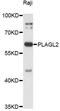 Zinc finger protein PLAGL2 antibody, LS-C749322, Lifespan Biosciences, Western Blot image 