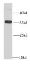 Replication factor C subunit 5 antibody, FNab07251, FineTest, Western Blot image 