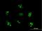UTP14A Small Subunit Processome Component antibody, H00010813-B01P, Novus Biologicals, Immunocytochemistry image 