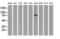 10-FTHFDH antibody, GTX84895, GeneTex, Western Blot image 