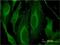 Leucine Rich Repeat Kinase 1 antibody, H00079705-M03, Novus Biologicals, Immunocytochemistry image 
