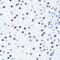 Histone Cluster 3 H3 antibody, GTX33905, GeneTex, Immunohistochemistry paraffin image 