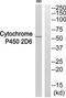 Cytochrome P450 Family 2 Subfamily D Member 6 antibody, TA313725, Origene, Western Blot image 