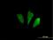F-Box Protein 9 antibody, H00026268-B01P, Novus Biologicals, Immunocytochemistry image 