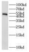 NSFL1 Cofactor antibody, FNab05868, FineTest, Western Blot image 