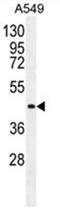Angiopoietin 2 antibody, AP50176PU-N, Origene, Western Blot image 