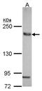 AE 2 antibody, NBP2-15301, Novus Biologicals, Western Blot image 