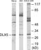 Distal-Less Homeobox 5 antibody, EKC1755, Boster Biological Technology, Western Blot image 