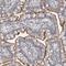 SPATA31 Subfamily E Member 1 antibody, NBP1-93822, Novus Biologicals, Immunohistochemistry frozen image 