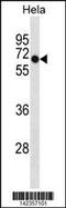 DEP Domain Containing 7 antibody, 60-853, ProSci, Western Blot image 
