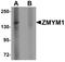 Zinc Finger MYM-Type Containing 1 antibody, A18075, Boster Biological Technology, Western Blot image 