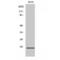 Zinc Finger HIT-Type Containing 1 antibody, LS-C386753, Lifespan Biosciences, Western Blot image 