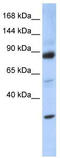 Zinc Fingers And Homeoboxes 3 antibody, TA344506, Origene, Western Blot image 