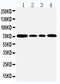 Heat Shock Protein Family A (Hsp70) Member 5 antibody, LS-C312961, Lifespan Biosciences, Western Blot image 