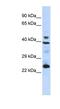 Selenoprotein P antibody, NBP1-70770, Novus Biologicals, Western Blot image 