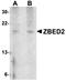 Zinc Finger BED-Type Containing 2 antibody, orb75179, Biorbyt, Western Blot image 