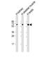 Doublesex And Mab-3 Related Transcription Factor 2 antibody, M10308, Boster Biological Technology, Western Blot image 