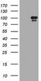 Hepatocyte Growth Factor-Regulated Tyrosine Kinase Substrate antibody, TA505832AM, Origene, Western Blot image 