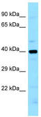 LIM Zinc Finger Domain Containing 2 antibody, TA338297, Origene, Western Blot image 