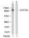 STAT5A antibody, AP02590PU-N, Origene, Western Blot image 
