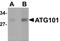 Autophagy-related protein 101 antibody, AHP2243, Bio-Rad (formerly AbD Serotec) , Enzyme Linked Immunosorbent Assay image 