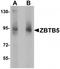 Zinc Finger And BTB Domain Containing 5 antibody, TA319801, Origene, Western Blot image 