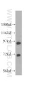 DNA replication licensing factor MCM8 antibody, 16451-1-AP, Proteintech Group, Western Blot image 